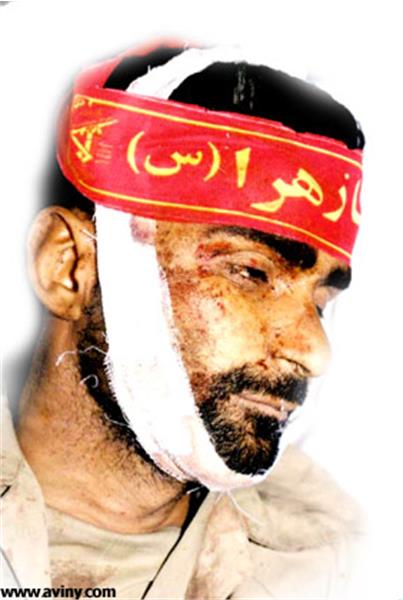 شهید علیرضا غلامی